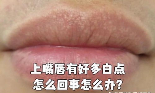 真爱1号药治啥病得-真爱喷雾剂说明书网- 真爱1号医用液体是治疗什么的知识,分享真爱1号医用液体敷料干什么用的